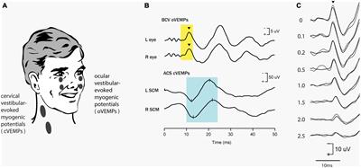 Similarities and Differences Between Vestibular and Cochlear Systems – A Review of Clinical and Physiological Evidence